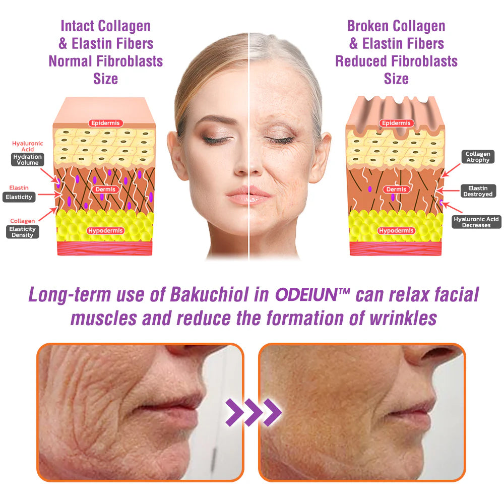 🇺🇸Made in an FDA-Registered Facility: ODEIUN™ 𝐐𝐮𝐞𝐞𝐧 𝐍𝐞𝐜𝐭𝐚𝐫 𝐏𝐞𝐩𝐭𝐢𝐝𝐞 + 𝐁𝐚𝐤𝐮𝐜𝐡𝐢𝐨𝐥 𝐒𝐤𝐢𝐧 𝐑𝐞𝐬𝐭𝐨𝐫𝐚𝐭𝐢𝐨𝐧 𝐂𝐫𝐞𝐚𝐦 - 𝐀𝐧𝐭𝐢-𝐚𝐠𝐢𝐧𝐠, 𝐇𝐲𝐝𝐫𝐚𝐭𝐢𝐧𝐠, 𝐒𝐤𝐢𝐧 𝐅𝐢𝐫𝐦𝐢𝐧𝐠 & 𝐋𝐢𝐟𝐭𝐢𝐧𝐠, 𝐒𝐤𝐢𝐧 𝐑𝐞𝐩𝐚𝐢𝐫, 𝐄𝐯𝐞𝐧 𝐓𝐨𝐧𝐞