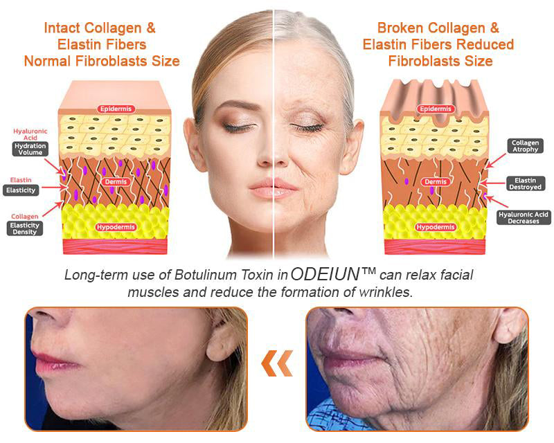 Made and Shipped from USA ✨ ODEIUN™ Bee venom Comprehensive Cream 🔥 LAST DAY 80% OFF 💎💎