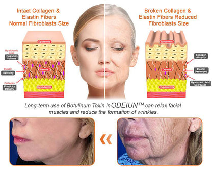 Made and Shipped from USA ✨ ODEIUN™ Bee venom Comprehensive Cream 🔥 LAST DAY 80% OFF 💎💎