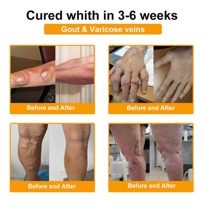 🎁Flash Sale - ODALIT™ Botulinum Toxin & Bee Venom Pain-Relief Bone Healing Cream🐝💎