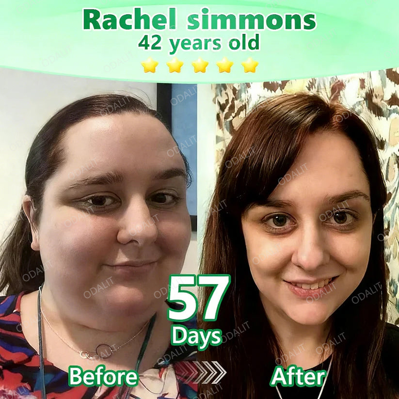 [FDA-Registered & Clinical support] 🇺🇸 ODALIT® L-Carnitine × Retinol | Slimming & Firming 2-in-1 Nano Microneedle Patch 🔥 Obesity, Diabetes, Sleep Apnea, And Joint Issues⏳