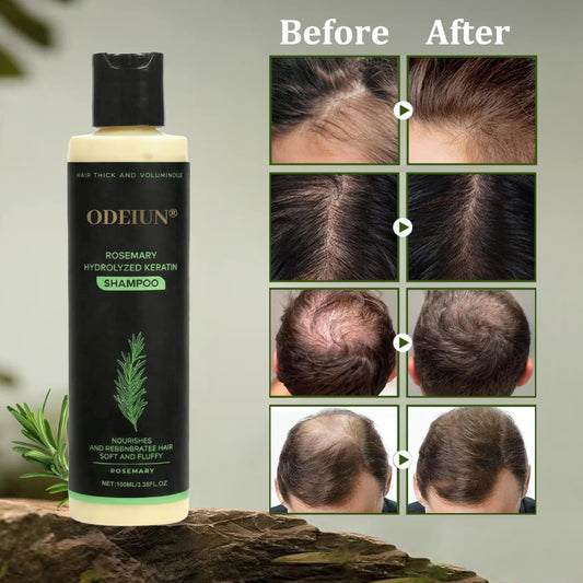 🌱 Organic Rosemary Hair Growth Shampoo