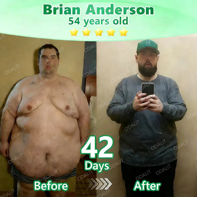 [FDA-Registered & Clinical support] 🇺🇸 ODALIT® L-Carnitine × Retinol | Slimming & Firming 2-in-1 Nano Microneedle Patch 🔥 Obesity, Diabetes, Sleep Apnea, And Joint Issues⏳