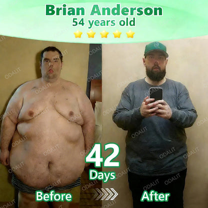 [FDA-Registered & Clinical support] 🇺🇸 ODALIT® L-Carnitine × Retinol | Slimming & Firming 2-in-1 Nano Microneedle Patch 🔥 Obesity, Diabetes, Sleep Apnea, And Joint Issues⏳