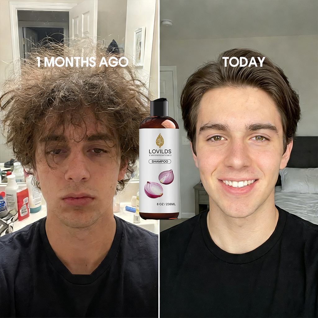 🌱 Regrow Your Hair Naturally —Onion Repair & Growth Shampoo