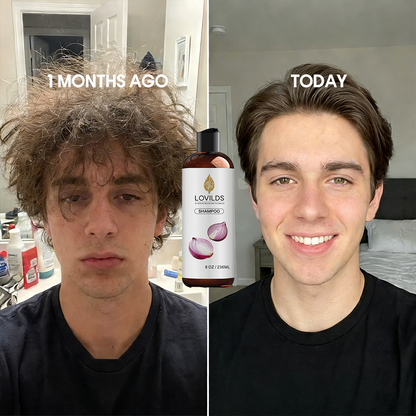 🌱 Regrow Your Hair Naturally —Onion Repair & Growth Shampoo
