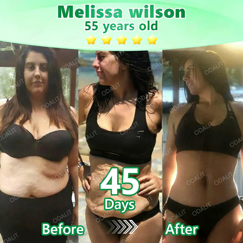 [FDA-Registered & Clinical support] 🇺🇸 ODALIT® L-Carnitine × Retinol | Slimming & Firming 2-in-1 Nano Microneedle Patch 🔥 Obesity, Diabetes, Sleep Apnea, And Joint Issues⏳