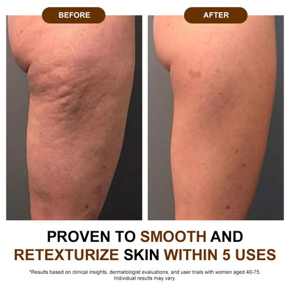 ✅ODEIUN® 𝐒𝐢𝐥𝐤 𝐁𝐨𝐝𝐲 𝐎𝐢𝐥 ✨ Firms, Lifts & Smooths the Skin, Reduces Wrinkles, and Restores Youthful Elasticity