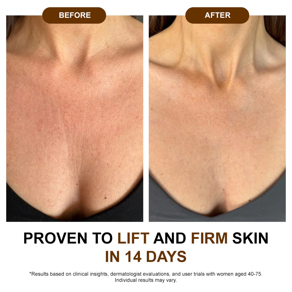 ✅ODEIUN® 𝐒𝐢𝐥𝐤 𝐁𝐨𝐝𝐲 𝐎𝐢𝐥 ✨ Firms, Lifts & Smooths the Skin, Reduces Wrinkles, and Restores Youthful Elasticity