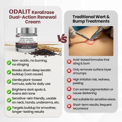 ✅Flash Sale - ODALIT®KeraErase Dual-Action Renewal Cream