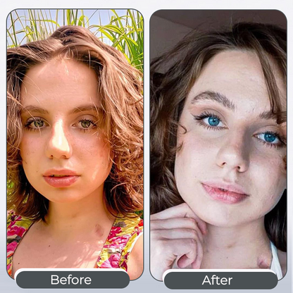 ODEIUN™ 𝑺𝒑𝒆𝒄𝒕𝒓𝒂𝑬𝒚𝒆 𝑪𝒐𝒍𝒐𝒓 𝑪𝒉𝒂𝒏𝒈𝒊𝒏𝒈 𝑫𝒓𝒐𝒑𝒔 𝑷𝒓𝒐 （👁️ Clinically Tested & Ophthalmologist Approved）